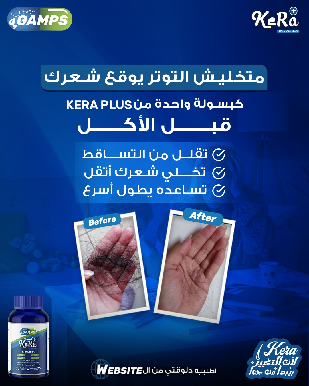 2 KeRa plus+Nail lotion ( لعلاج ضعف الشعر والضوافر والبشرة )