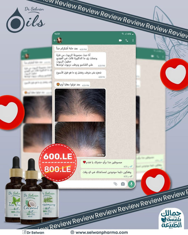 Rosmary oil + Tea Tree oil + Coconut oil لعلاج تساقط الشعر والقشرة